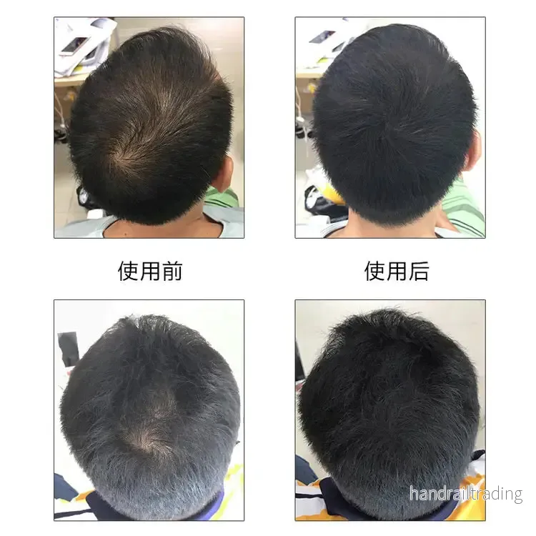 Kingyes Hair Fiber Spray - Bild 2