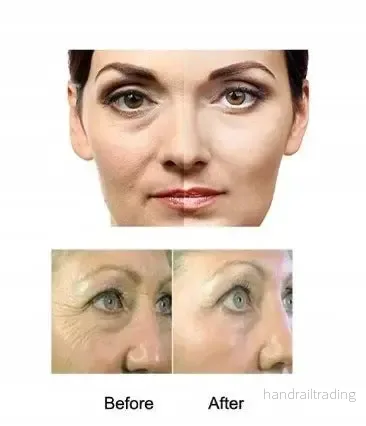 Derma Roller 3-i-1 Guld - Bild 3