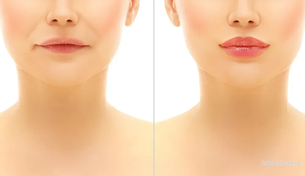 Fillers Utbildning Advanced